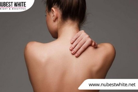 10+ Cách làm trắng da vùng lưng hiệu quả nhanh chóng tại nhà