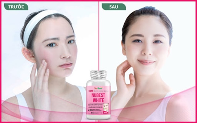 NuBest White bảo vệ da, tăng cường sức đề kháng cho da thêm hồng hào, trắng mịn