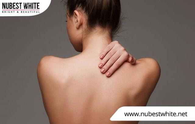 Da lưng sạm đen khiến nhiều người cảm thấy tự ti