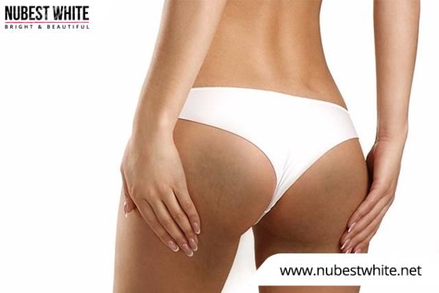 Da mông bị thâm đen do nhiều nguyên nhân